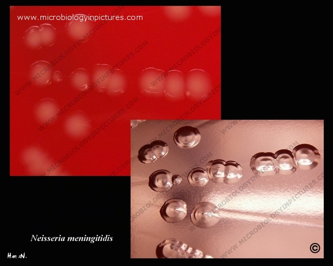 neisseria meningitidis colony morphology, prolonged cultivation